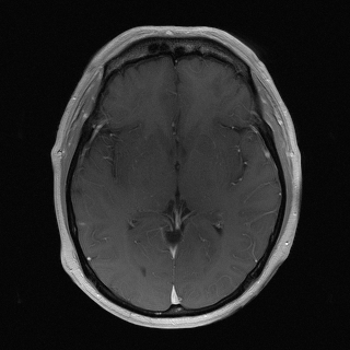 Brain MRI volume animation